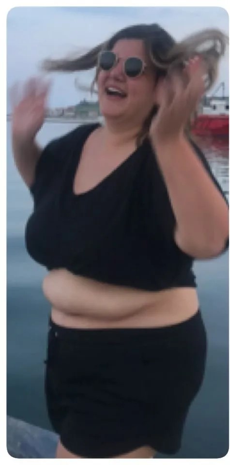 Istanbul Bariatric Center — Gastric Sleeve before